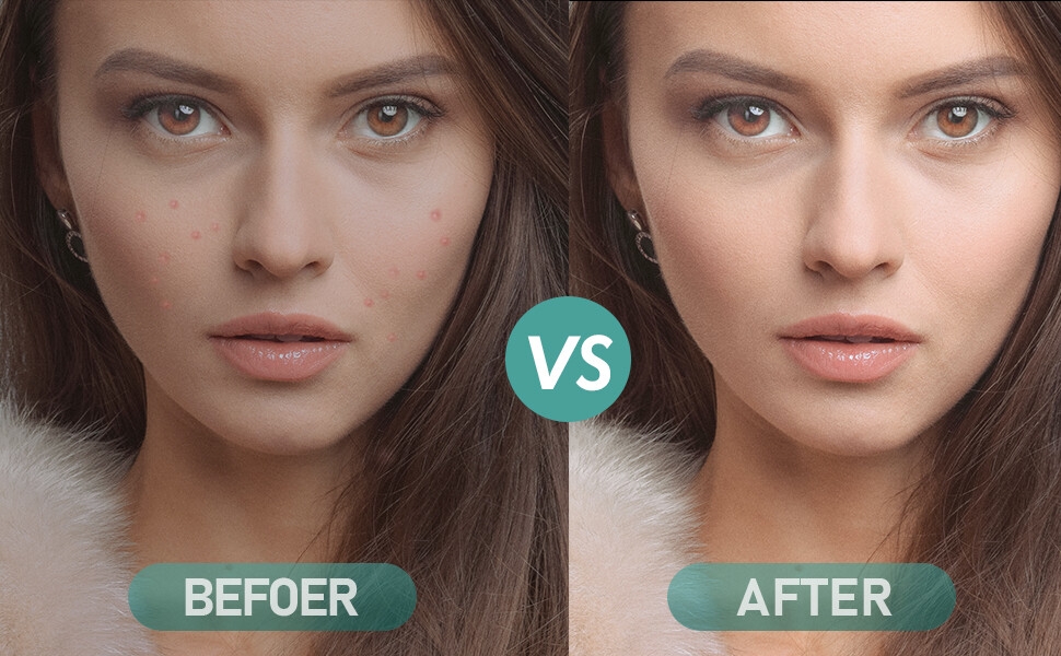 pimple patches acne starface patch for face star cute hydrocolloid mighty