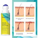 product_image_name-Generic-Razor Bump Treatment Solution for Men and Women Ingrown Hair Repair-6