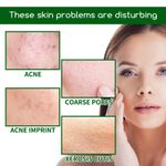 product_image_name-Gm-AHA 30% + BHA 2% Peeling Solution Facial Serum Eliminates Acne Scars Skin Brightening 10 ml-5