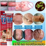 product_image_name-Generic-Skin Tag and Keloid Removing Cream – Red-4