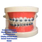 product_image_name-Professional-Dental Clinic Othodontic Metal Tooth/Brace - Student/Education Practical Purposes (Box Contains Teeth & Fixed Brace on the Teeth) Patient Display -6