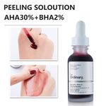 The Ordinary AHA 30% + BHA 2% Peeling Solution (30ml) – 10-Minute Exfoliating Facial - image 3