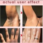 product_image_name-Generic-Bleaching Armpits Elbows Knees  Body Lotion  Brighten Lightening Melanin-2