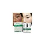 Moo Yam Dark Spot Corrector - 50ml