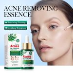 SADOER Tea Tree Acnes Oil Control Face Serum (30ml) – Clear & Radiant Skin Formula - image 2