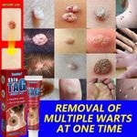 product_image_name-Generic-Skin Tag and Keloid Removing Cream – Red-4