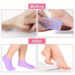 product_image_name-ShebSheb-Silicone Moisturizing Socks for Dry Cracked Feet, Reusable Hydrating Heel Treatment Foot Care Socks for Women and Men-2