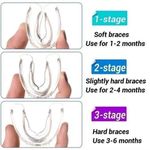 Generic 3Pcs Set Teeth Brace Corrector Bend Aligner - image 3