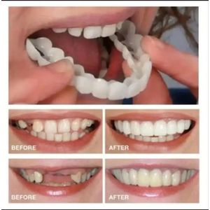 Health Set of 2 Removable White Dentures – Natural Smile Enhancer, Washable & Reusable Upper & Lower Cosmetic Teeth Covers