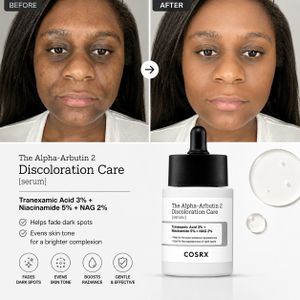 corsx The Alpha-Arbutin 2 Discoloration Care Serum - Fades Dark Spots, Post-Acne Scars & Hyperpigmentation (Niacinamide 5% + Tranexamic Acid 3%)