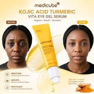Medicube Kojic Acid Turmeric Vita Eye Gel Serum/As compared to Seoul 1988 – 30ml
