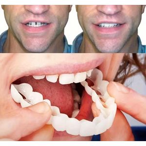 Health Set of 2 Removable White Dentures – Natural Smile Enhancer, Washable & Reusable Upper & Lower Cosmetic Teeth Covers