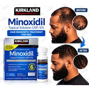 Kirkland Signature minoxidil oil box for hair and beard growth treatment