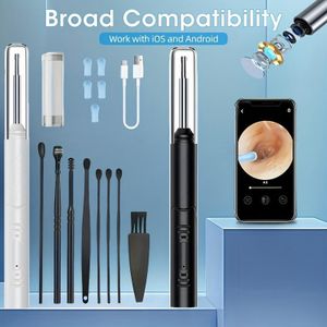 Healthcheck Visual Earwax Removal Endoscope Tool Set – HD Camera Ear Cleaner with LED Light & Smart Viewing (USB/WiFi Otoscope)