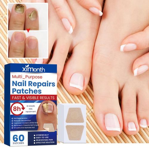 product_image_name-Generic-Toenail Fungus Cleansing Extra Strength,60pcs Fungal Nail Patches 8-Hour Overnight Nail Repair Effortless Restore Healthy Nail Appearance-1