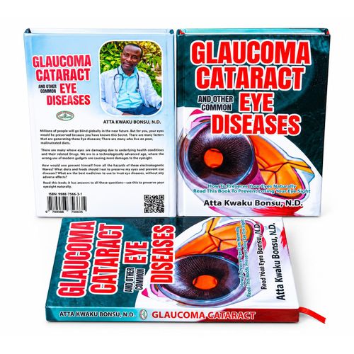 Generic Glaucoma Cataract And Other Common Eye Diseases - Book