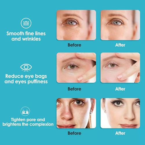 product_image_name-Generic-Ice Globe Facial Massager (2pcs) - Pink-5