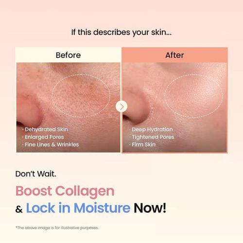 product_image_name-Generic-Bio-Collagen Real Deep Mask (4pcs) - Intensive Hydration, Firming & Anti-Aging Sheet Mask-6