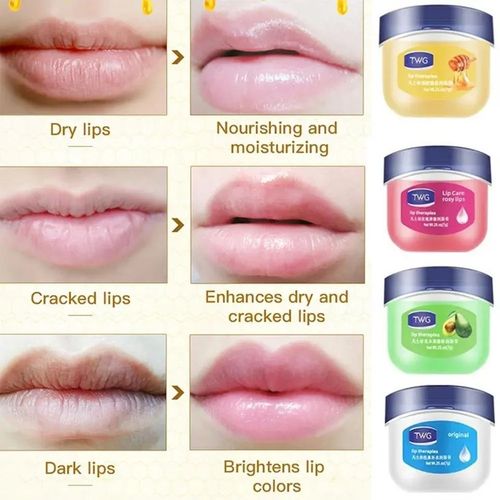Vaseline 6 Pcs Lip Gloss Lip Therapy Balm -Rosy Lips 7g - image 2