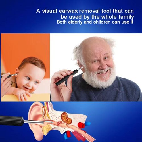 Generic Visual Ear Pick Set, HD Earwax Removal Tool - image 8