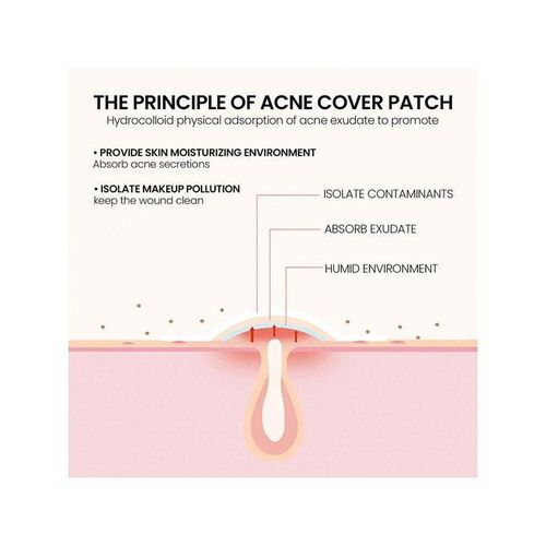 product_image_name-Generic-200pcs Acne Pimple Patch, Holiday Party Heart Shaped Star Decoration Sticker, Halloween Supplies-5