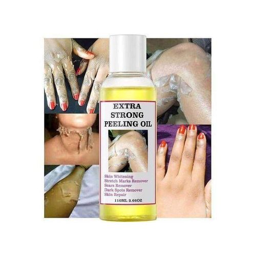 Generic Peeling Oil For Dark Skin -110ML - image 2