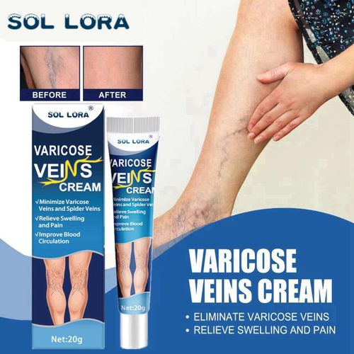 Generic SOL LORA Varicose Veins Cream – 20g - image 3