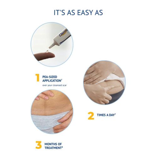 product_image_name-Dermatix-Advanced Scar Gel - 15g-8