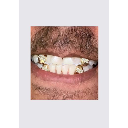 Jewelry Fashion 4pcs × Tooth Grill Heart Pattern Hip-Hop Style Life - Party/Entertainment Teeth Grillz Flex - Street Fun- Tooth Fashion Tool - Teeth Beauty - Gold Mix Design - image 3
